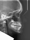 téléradiographie numérique de profil bilan orthodontique au cabinet d'orthodontie à Chalon-sur-Saône