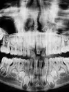 radio panoramique pour bilan orthodontique