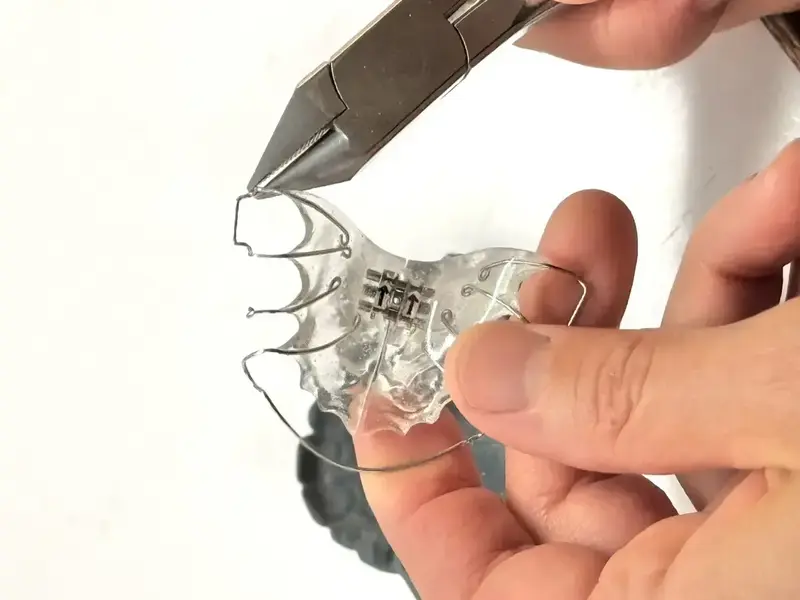 Conception d'un appareil dentaire pour enfant.