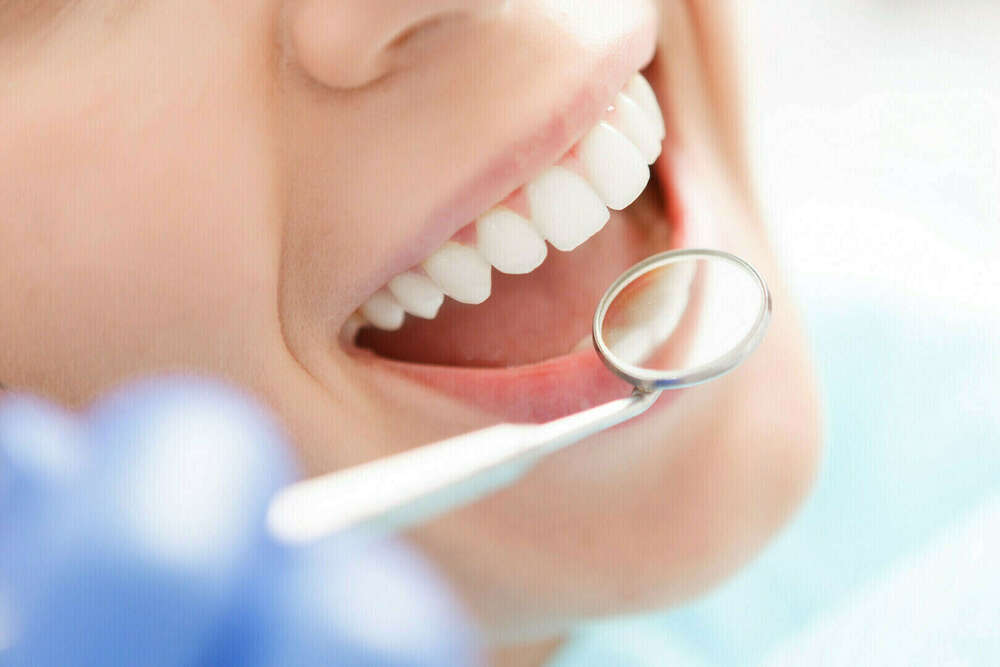 L'usure dentaire