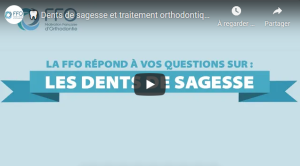  Dents de sagesse et traitement orthodontique : Que faire ?