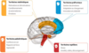 Cerveau hypnose