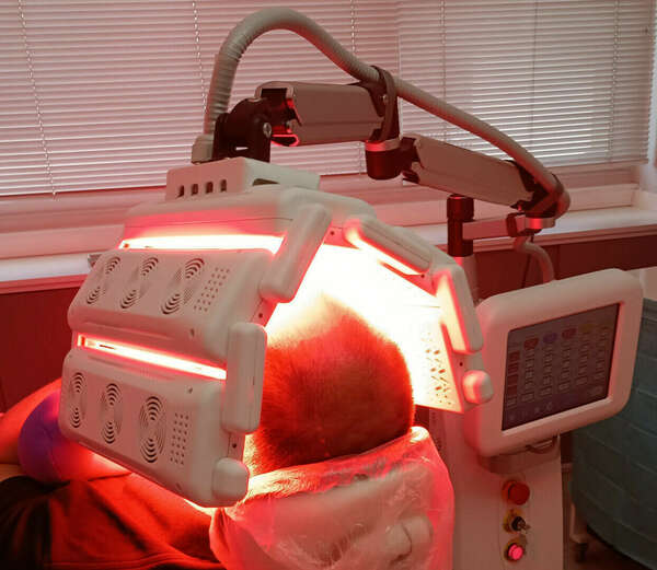 PHOTOBIOMODULATION :