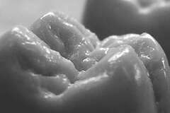 Le blanchiment dentaire au fauteuil à Rhinau près de Sélestat - Strasbourg - Colmar