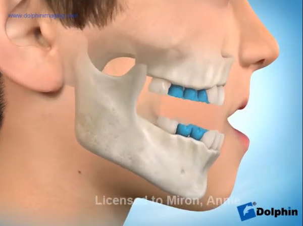 LE MASQUE DE DELAIRE