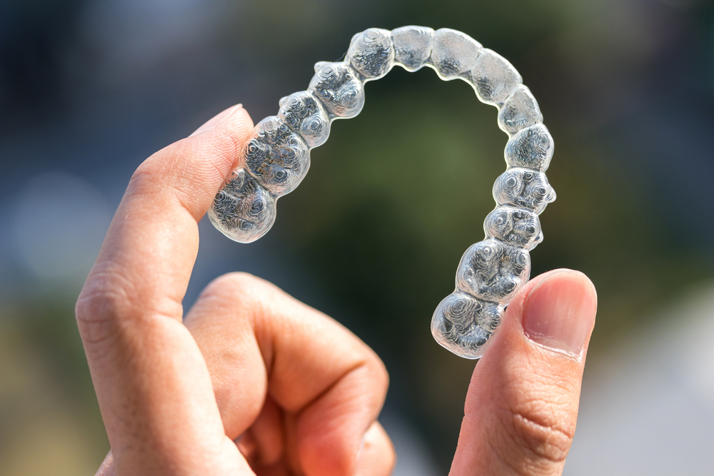 Orthodontie par aligneurs invisibles au cabinet dentaire du Dr Remy, dentiste à Paris 7