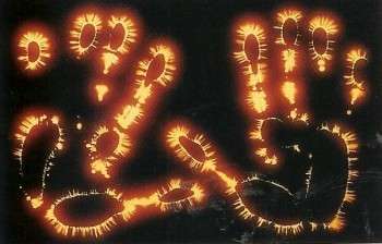 Le Coupeur de Feu et le zona