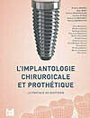 implant et prothèse