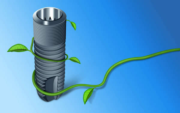 Qu'est-ce qu'un implant ? Indications et contre-indications