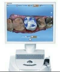 Les reconstructions possibles avec la CFAO et l’utilisation de la céramique