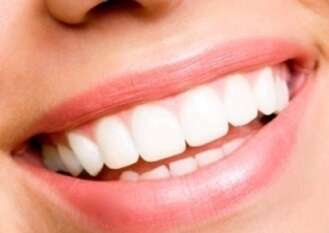 Les Inlays en céramique