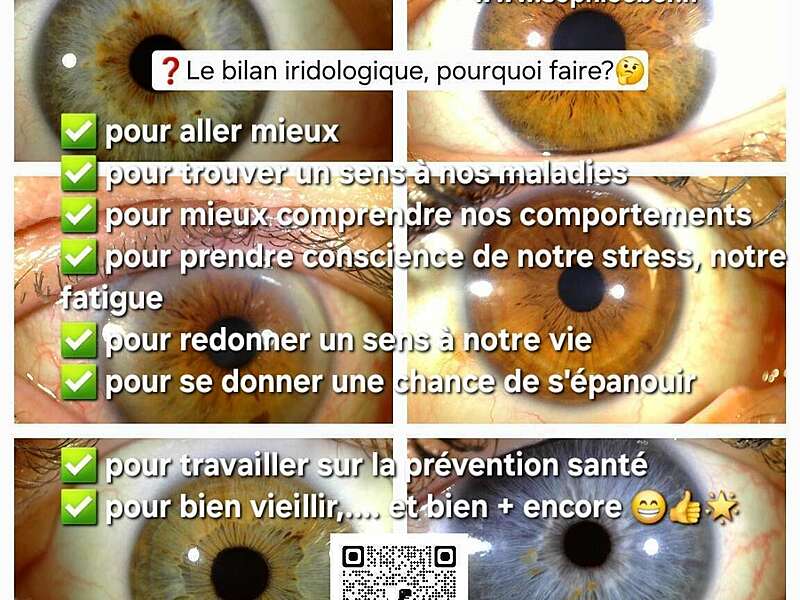 iridologie-c_est_quoi-_www-sophieeber-fr_