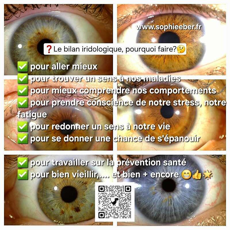 iridologie-c_est_quoi-_www-sophieeber-fr_