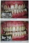 Effet photodynamique pour purification et décontamination efficace