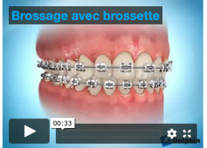 Brossage avec brossette