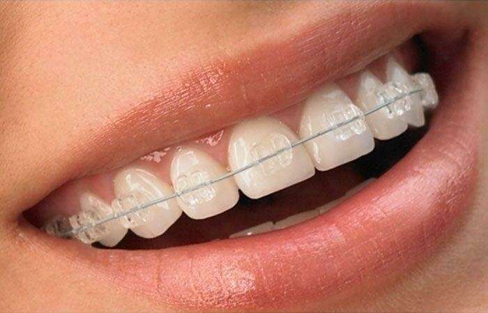 er9a4lctmv_1591179383
