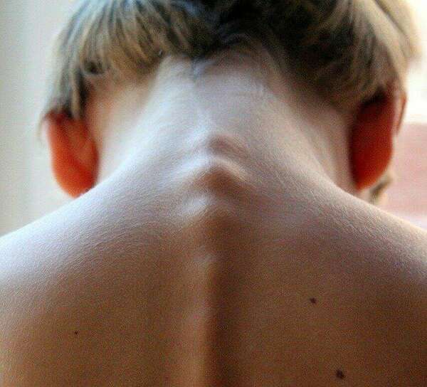 Un article très intéressant sur la chiropraxie et pourquoi consulter!