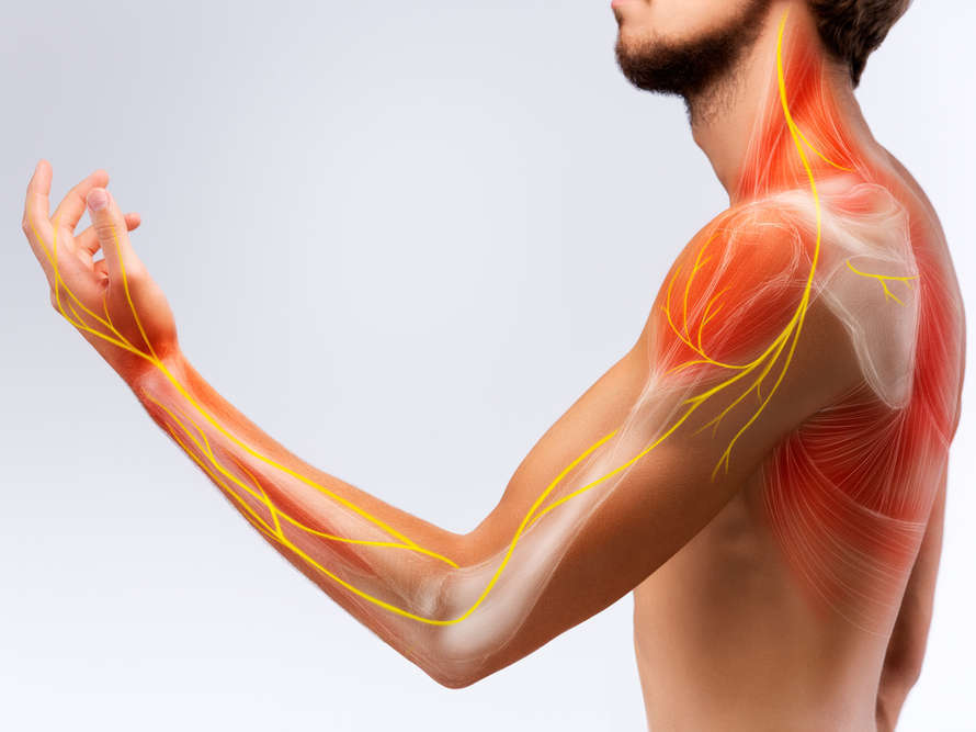 Nvralgie cervico-brachiale | AFC - Association Franaise de Chiropraxie