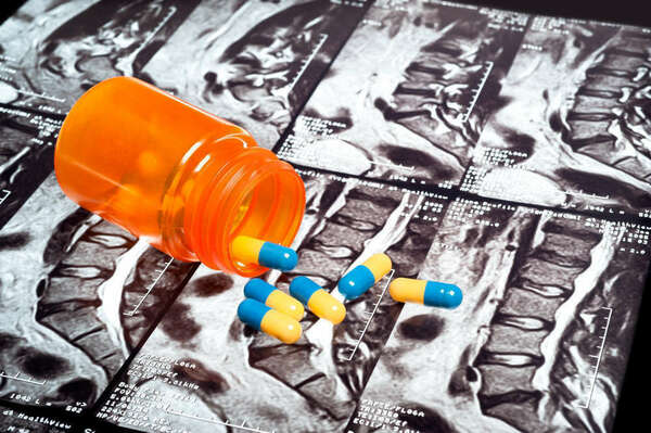 Les effets limités des anti-inflammatoires sur la lombalgie aigue