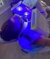 photobiomodulation