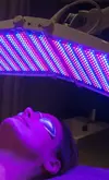 La photobiostimulation