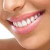 Sourire