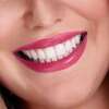 Sourire