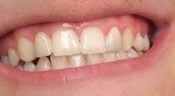 Exemples de traitement