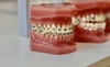 orthodontie de l'adolescent, dr Camille Mathieu-bouclet, Amiens 80090