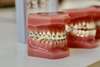 Bouche avec bagues orthodontiques et dents saines