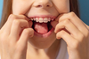 Enfant montrant ses dents, orthodontie de l'enfant à Amiens