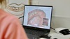 Empreinte numérique 3D des dents affichée sur ordinateur