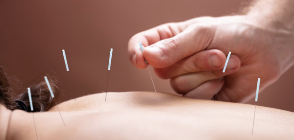 Acupuncture : pourquoi parle-t-on de « sensation d’aiguille » et pourquoi est-ce si important ?