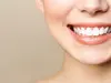 Sourire d'une patiente