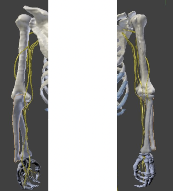 Anatomie 3D des nerfs du membre supérieur gauche par osteopathe versailles