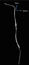 Modélisation 3D du nerf musculo-cutané par osteopathe versailles yvelines 78