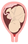 placenta normal grossesse