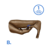 syndrome d'ehlers danlos osteopathe test de breighton
