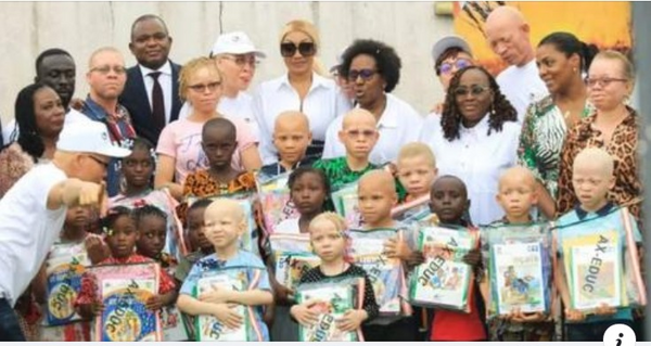 Côte d’Ivoire : Emma Lohoues offre des fournitures scolaires aux enfants albinos